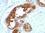 TAG-72/CA72.4 (Tumor-Associated Glycoprotein) Antibody in Immunohistochemistry (Paraffin) (IHC (P))