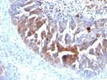 TAG-72/CA72.4 (Tumor-Associated Glycoprotein) Antibody in Immunohistochemistry (Paraffin) (IHC (P))