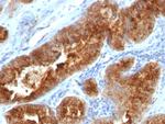 TAG-72/CA72.4 (Tumor-Associated Glycoprotein) Antibody in Immunohistochemistry (Paraffin) (IHC (P))