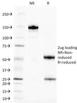 TAG-72/CA72.4 (Tumor-Associated Glycoprotein) Antibody in SDS-PAGE (SDS-PAGE)