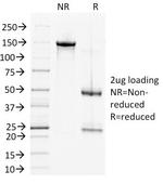 Desmoglein-2 (DSG2) Antibody in SDS-PAGE (SDS-PAGE)