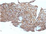 Desmoglein-3 Antibody in Immunohistochemistry (Paraffin) (IHC (P))