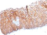 Desmoglein-3 Antibody in Immunohistochemistry (Paraffin) (IHC (P))