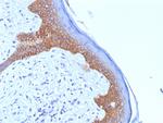 Desmoglein-3 (Squamous Cell Marker) Antibody in Immunohistochemistry (Paraffin) (IHC (P))