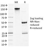 Desmoglein-3 (Squamous Cell Marker) Antibody in SDS-PAGE (SDS-PAGE)