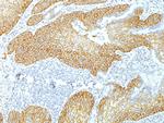 Desmoglein-3 Antibody in Immunohistochemistry (Paraffin) (IHC (P))