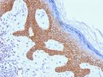 Desmoglein-3 Antibody in Immunohistochemistry (Paraffin) (IHC (P))