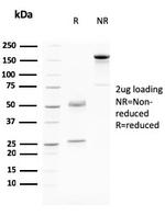 Desmoglein-3 Antibody in SDS-PAGE (SDS-PAGE)