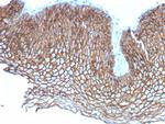 Desmoglein-3 (Squamous Cell Marker) Antibody in Immunohistochemistry (Paraffin) (IHC (P))