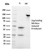 Desmoglein-3 (Squamous Cell Marker) Antibody in SDS-PAGE (SDS-PAGE)