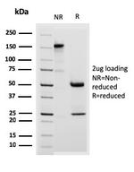 Desmoglein-3 Antibody in SDS-PAGE (SDS-PAGE)