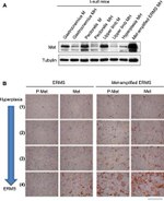 c-Met Antibody in Western Blot, Immunohistochemistry (Paraffin) (WB, IHC (P))