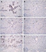 ZO-1 Antibody in Immunohistochemistry (IHC)