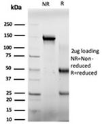 E4F1 Antibody in SDS-PAGE (SDS-PAGE)