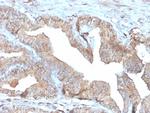 Thymidine Phosphorylase/PD-ECGF Antibody in Immunohistochemistry (Paraffin) (IHC (P))