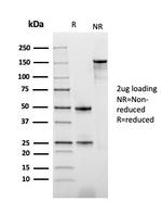 Thymidine Phosphorylase/PD-ECGF Antibody in SDS-PAGE (SDS-PAGE)