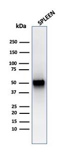 Thymidine Phosphorylase/PD-ECGF Antibody in Western Blot (WB)