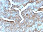 Thymidine Phosphorylase/PD-ECGF Antibody in Immunohistochemistry (Paraffin) (IHC (P))