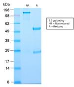 Thymidine Phosphorylase/PD-ECGF Antibody in SDS-PAGE (SDS-PAGE)