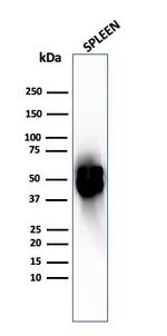 Thymidine Phosphorylase/PD-ECGF Antibody in Western Blot (WB)