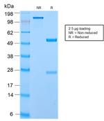 Secretory Component/ECM1 Antibody in SDS-PAGE (SDS-PAGE)