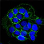 EGFR (Epidermal Growth Factor Receptor) Antibody in Immunocytochemistry (ICC/IF)