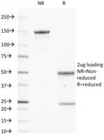 EGFR (Epidermal Growth Factor Receptor) Antibody in SDS-PAGE (SDS-PAGE)