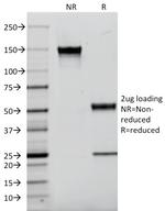 EGFR (Epidermal Growth Factor Receptor) Antibody in SDS-PAGE (SDS-PAGE)