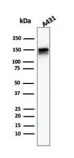 EGFR (Epidermal Growth Factor Receptor) Antibody in Western Blot (WB)