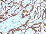 EGFR (Epidermal Growth Factor Receptor) Antibody in Immunohistochemistry (Paraffin) (IHC (P))