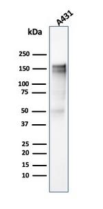 EGFR (Epidermal Growth Factor Receptor) Antibody in Western Blot (WB)