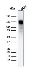 EGFR (Epidermal Growth Factor Receptor) Antibody in Western Blot (WB)