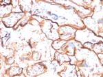 EGFR (Epidermal Growth Factor Receptor) Antibody in Immunohistochemistry (Paraffin) (IHC (P))