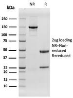 EGFR (Epidermal Growth Factor Receptor) Antibody in SDS-PAGE (SDS-PAGE)