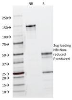 EGFR (Epidermal Growth Factor Receptor) Antibody in SDS-PAGE (SDS-PAGE)