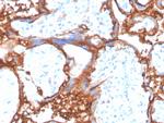 EGFR (Epidermal Growth Factor Receptor) Antibody in Immunohistochemistry (Paraffin) (IHC (P))