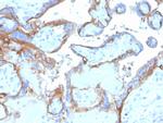 EGFR (Epidermal Growth Factor Receptor) Antibody in Immunohistochemistry (Paraffin) (IHC (P))