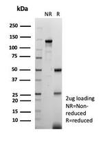 EGFR (Epidermal Growth Factor Receptor) Antibody in SDS-PAGE (SDS-PAGE)