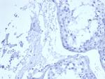 EGFR (Epidermal Growth Factor Receptor) Antibody in Immunohistochemistry (Paraffin) (IHC (P))