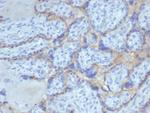 EGFR (Epidermal Growth Factor Receptor) Antibody in Immunohistochemistry (Paraffin) (IHC (P))