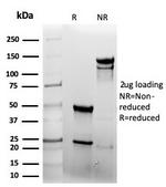 EGFR (Epidermal Growth Factor Receptor) Antibody in SDS-PAGE (SDS-PAGE)