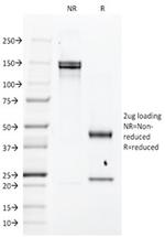 EGFR (Epidermal Growth Factor Receptor) Antibody in SDS-PAGE (SDS-PAGE)