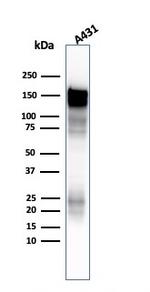 EGFR (Epidermal Growth Factor Receptor) Antibody in Western Blot (WB)