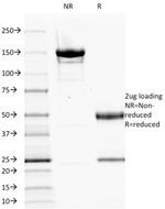 EGFR (Epidermal Growth Factor Receptor) Antibody in SDS-PAGE (SDS-PAGE)