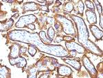 EGFR (Epidermal Growth Factor Receptor) Antibody in Immunohistochemistry (Paraffin) (IHC (P))