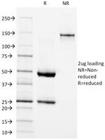 EGFR (Epidermal Growth Factor Receptor) Antibody in SDS-PAGE (SDS-PAGE)