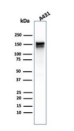 EGFR (Epidermal Growth Factor Receptor) Antibody in Western Blot (WB)