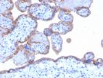 EGFR (Epidermal Growth Factor Receptor) Antibody in Immunohistochemistry (Paraffin) (IHC (P))