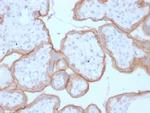 EGFR (Epidermal Growth Factor Receptor) Antibody in Immunohistochemistry (Paraffin) (IHC (P))