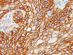 EGFR (Epidermal Growth Factor Receptor) Antibody in Immunohistochemistry (Paraffin) (IHC (P))